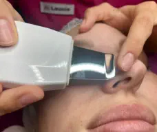 HyquaPeel Anwendung Kosmetikstudio Bine Landshut