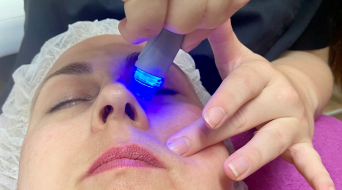 HyquaPeel Technologie © Foto: Kosmetikstudio Bine