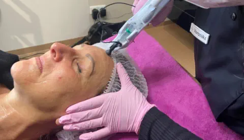 Schmerzfrei Nadelfrei - Anti Age - Infuzion