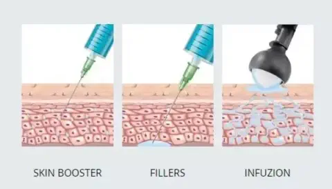 Infuzion Grafik © Infuzion