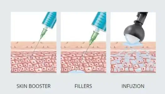 Infuzion Grafik © Infuzion