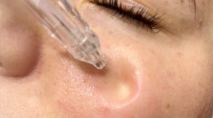 JetPeel Hydroporration © Foto: Kosmetikstudio Bine