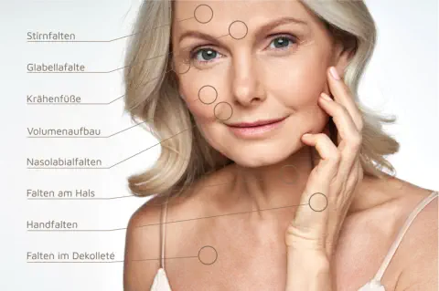 Seidenfadenlifting Landshut © Foto: insta_photos - stock.adobe.com