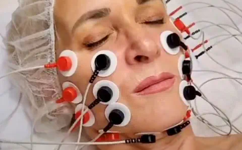 Liposana Gesicht - Foto © Bine