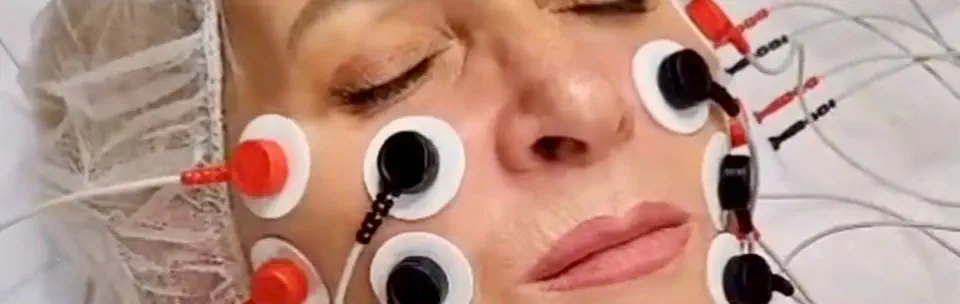 Liposana Gesicht - Foto © Bine