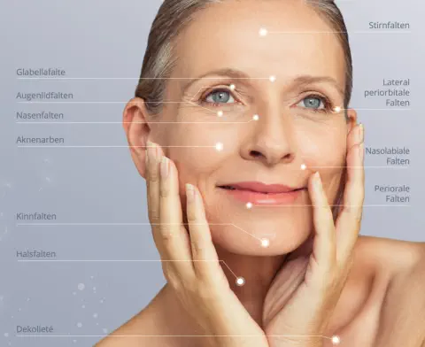 Behandlungsareale mit Mezotix © Foto: Rido - stock.adobe.com