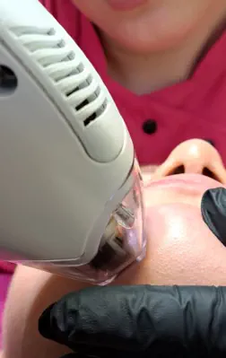 Mezotix Anwendung im Kosmetikstudio Bine in Landshut