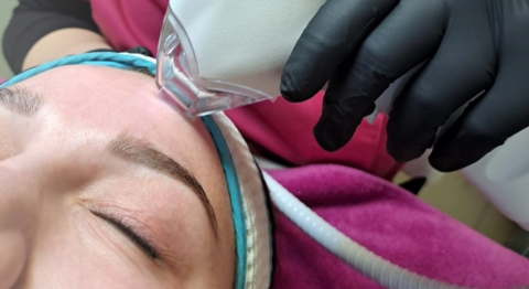 Mezotix Tixel Technologie ©Foto: Kosmetikstudio Bine