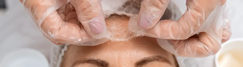 Seidenfadenlifting ohne Nadel ©Viktoryia - stock.adobe.com